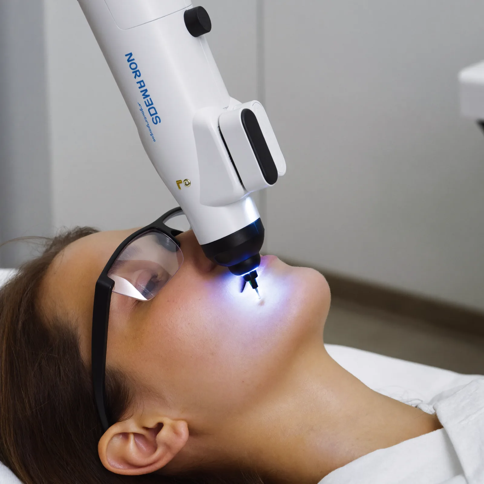 Laser skin treatment