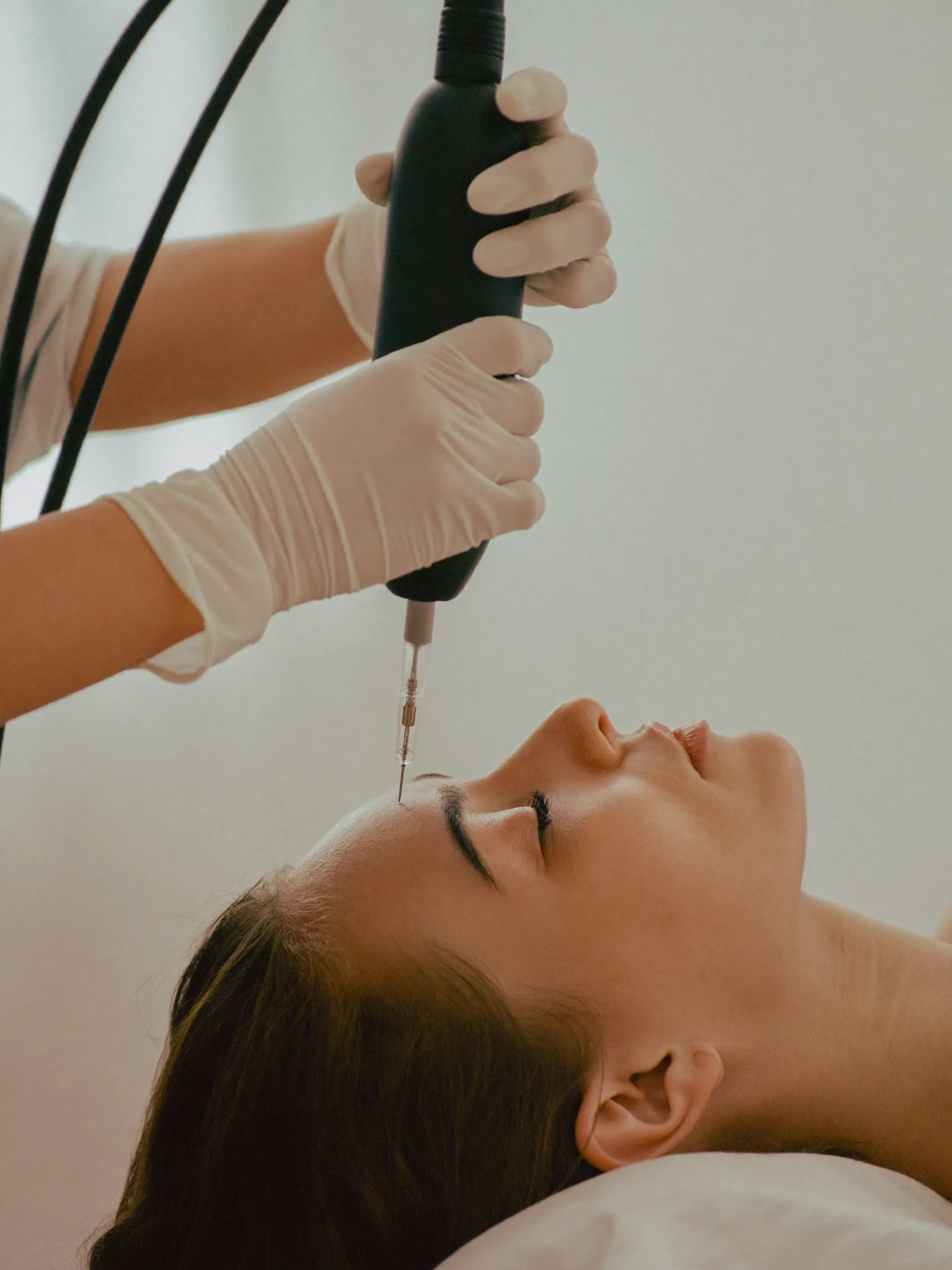 Microneedling